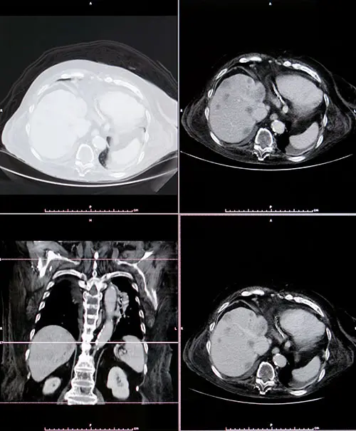 ct scan image